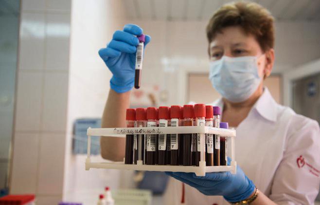 Preview image for The sustainability of the results of the last Global Fund HIV grant for Russia are under a threat